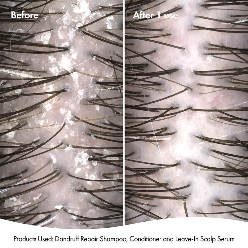 Bondi Boost Dandruff Repair Leave-In Scalp Serum 125ml