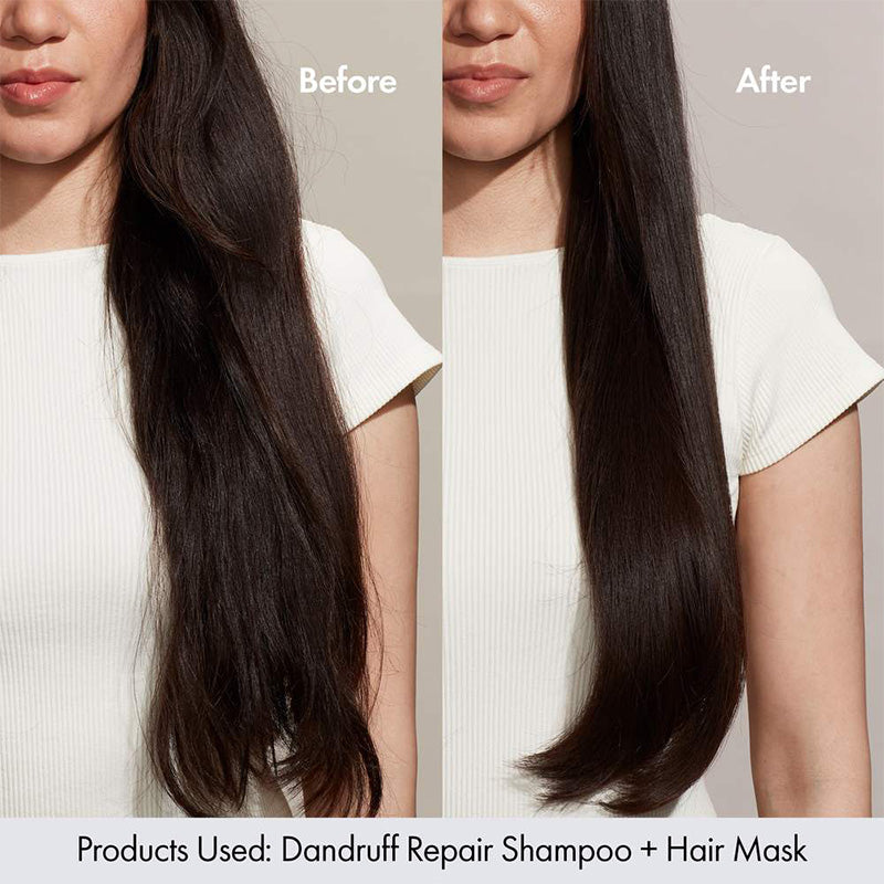 Bondi Boost Dandruff Repair Conditioner (300ml)